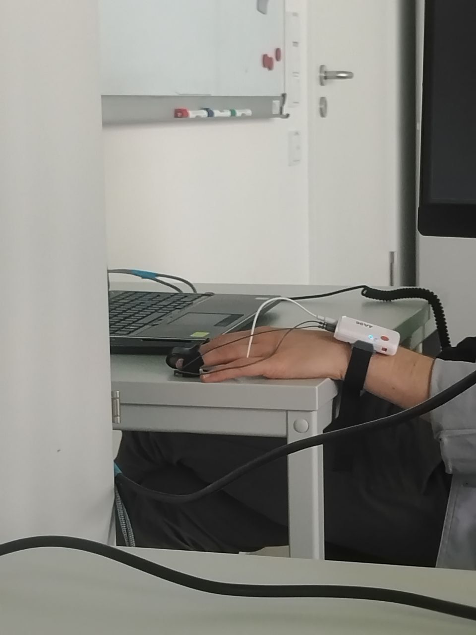 Shimmer Device on Hand